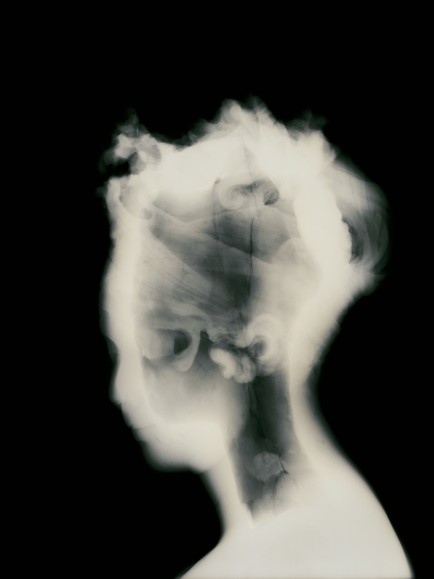 x-ray photograph of antique statue